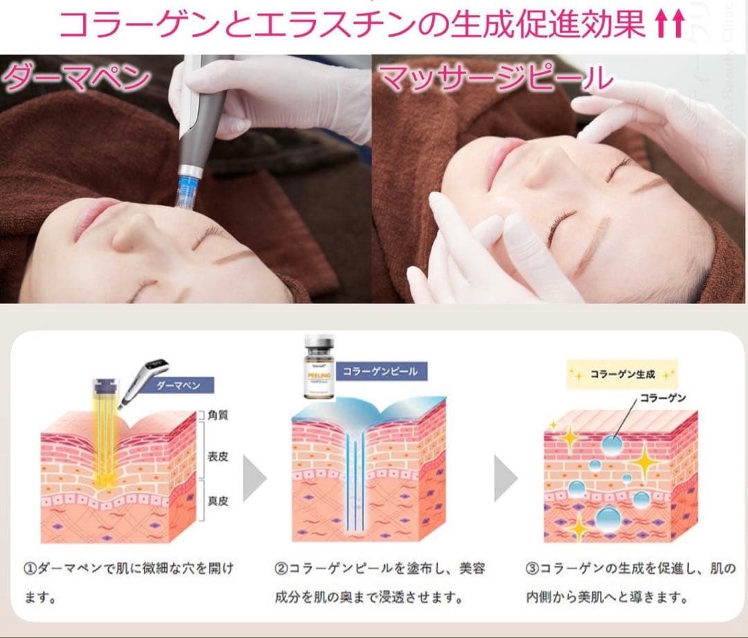 tai　マッサージピール、オーキッドグロー、水光スタンプ