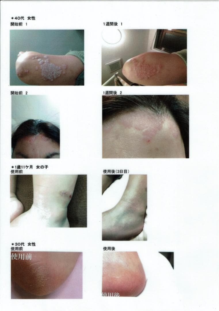 【新品2個】PharmaS1 ファルマS1 シコニンクリーム ノンステロイド