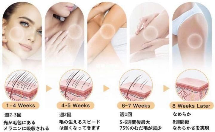 【現品限り☆処分大特価29800円→12800円】IPL冷感脱毛器 99万発
