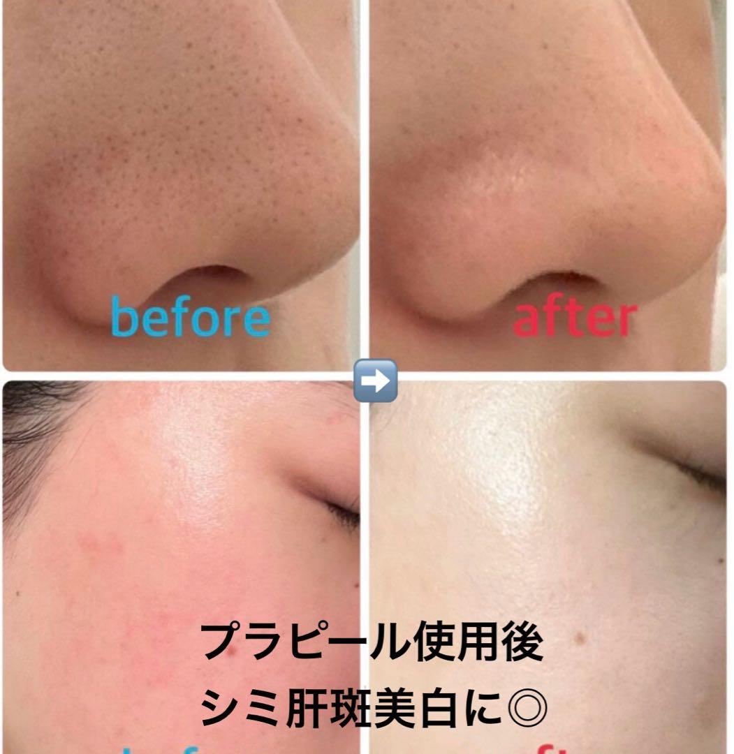 【週末限定SALE◎】プラピール【9回分】6,980円リピ割更に300円off